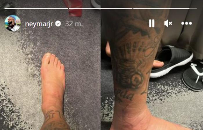 That doesn’t look good for Neymar: Brazilian superstar shares photo of swollen foot | 2022 football world cup