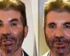 “What happened to his face?”: fans worried about ‘unrecognizable’ Simon Cowell | Celebrities