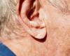 Sudden deafness due to cerebral vascular damage – NRC