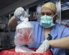 American dies two months after pig kidney transplant | RTL News