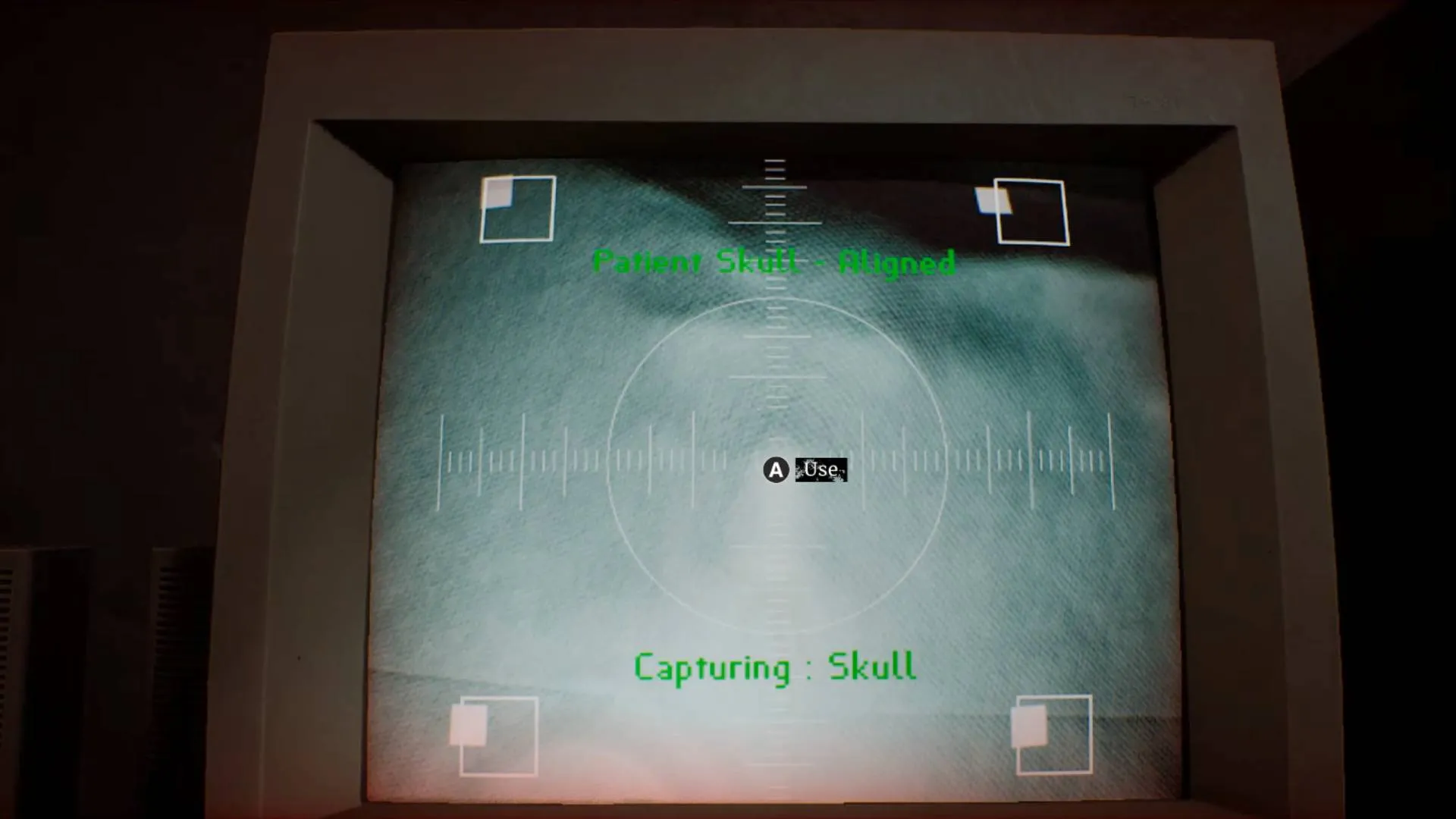 Silent Hill Townfall skull x-ray